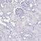 Solute Carrier Family 34 Member 2 antibody, PA5-58198, Invitrogen Antibodies, Immunohistochemistry paraffin image 