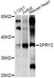 Sprouty RTK Signaling Antagonist 2 antibody, LS-C746797, Lifespan Biosciences, Western Blot image 