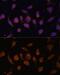 Hypoxia Inducible Factor 1 Subunit Alpha Inhibitor antibody, GTX32652, GeneTex, Immunocytochemistry image 