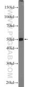 Tetratricopeptide repeat protein 7B antibody, 25713-1-AP, Proteintech Group, Western Blot image 
