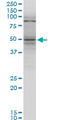 TNF Receptor Superfamily Member 25 antibody, LS-C139255, Lifespan Biosciences, Western Blot image 