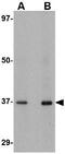 Aryl Hydrocarbon Receptor Interacting Protein Like 1 antibody, GTX17024, GeneTex, Western Blot image 