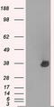 Aurora Kinase C antibody, M03809, Boster Biological Technology, Western Blot image 
