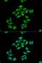 Carnitine Palmitoyltransferase 1A antibody, LS-C333970, Lifespan Biosciences, Immunofluorescence image 