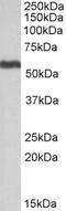 Aldehyde Dehydrogenase 5 Family Member A1 antibody, EB10435, Everest Biotech, Western Blot image 