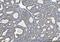 Glycine dehydrogenase [decarboxylating], mitochondrial antibody, M04777, Boster Biological Technology, Immunohistochemistry paraffin image 