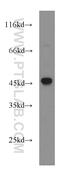Argininosuccinate Synthase 1 antibody, 16210-1-AP, Proteintech Group, Western Blot image 