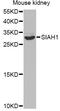 Siah E3 Ubiquitin Protein Ligase 1 antibody, MBS126656, MyBioSource, Western Blot image 