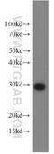 Proteasome Subunit Alpha 7 antibody, 15219-1-AP, Proteintech Group, Western Blot image 