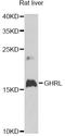 Ghrelin And Obestatin Prepropeptide antibody, LS-C747675, Lifespan Biosciences, Western Blot image 