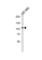 Neurotrophic Receptor Tyrosine Kinase 3 antibody, abx033619, Abbexa, Western Blot image 