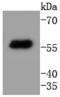 Keratin 4 antibody, A07410-2, Boster Biological Technology, Western Blot image 