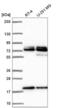 Nuclear pore complex protein Nup85 antibody, NBP2-56709, Novus Biologicals, Western Blot image 