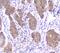 Survival Of Motor Neuron 2, Centromeric antibody, M03420-1, Boster Biological Technology, Immunohistochemistry frozen image 