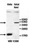 Hydroxylysine Kinase antibody, orb77502, Biorbyt, Western Blot image 