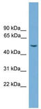 WD Repeat, Sterile Alpha Motif And U-Box Domain Containing 1 antibody, TA330511, Origene, Western Blot image 