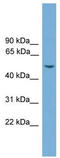 WD repeat, SAM and U-box domain-containing protein 1 antibody, TA330511, Origene, Western Blot image 