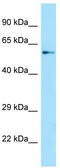 Sperm Associated Antigen 16 antibody, TA331229, Origene, Western Blot image 