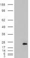 Cysteine And Glycine Rich Protein 2 antibody, orb19668, Biorbyt, Western Blot image 