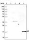Cofilin 2 antibody, NBP2-38544, Novus Biologicals, Western Blot image 