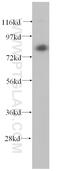 Transglutaminase 2 antibody, 15100-1-AP, Proteintech Group, Western Blot image 