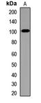 Sulfatase 2 antibody, LS-C668562, Lifespan Biosciences, Western Blot image 