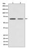 Glutamate Decarboxylase 1 antibody, M02002, Boster Biological Technology, Western Blot image 