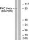 Protein Kinase C Theta antibody, LS-C199454, Lifespan Biosciences, Western Blot image 