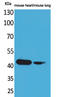 Actin Alpha Cardiac Muscle 1 antibody, STJ96475, St John