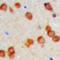 KDEL Endoplasmic Reticulum Protein Retention Receptor 2 antibody, orb393090, Biorbyt, Immunohistochemistry paraffin image 