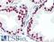 Androgen Receptor antibody, LS-B3326, Lifespan Biosciences, Immunohistochemistry frozen image 