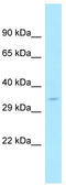 Leucine Zipper Protein 4 antibody, TA334320, Origene, Western Blot image 