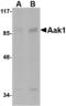 AP2 Associated Kinase 1 antibody, LS-B3833, Lifespan Biosciences, Western Blot image 