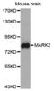 Microtubule Affinity Regulating Kinase 2 antibody, LS-C334384, Lifespan Biosciences, Western Blot image 