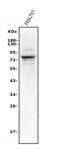 Alkaline Phosphatase, Biomineralization Associated antibody, A01008-1, Boster Biological Technology, Western Blot image 