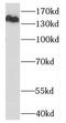 OTU Deubiquitinase 4 antibody, FNab06040, FineTest, Western Blot image 