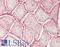 Crystallin Alpha B antibody, LS-C784382, Lifespan Biosciences, Immunohistochemistry paraffin image 