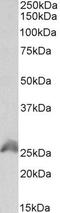 Homeobox protein Hox-B6 antibody, PA5-37867, Invitrogen Antibodies, Western Blot image 