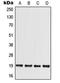 Mediator Complex Subunit 30 antibody, LS-C353598, Lifespan Biosciences, Western Blot image 
