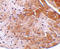 Cell Death Inducing DFFA Like Effector A antibody, LS-C298, Lifespan Biosciences, Immunohistochemistry paraffin image 