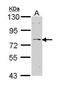 IL2 Inducible T Cell Kinase antibody, PA5-29668, Invitrogen Antibodies, Western Blot image 