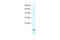 Purinergic Receptor P2X 6 antibody, 28-251, ProSci, Western Blot image 