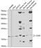 CD59 Molecule (CD59 Blood Group) antibody, GTX53909, GeneTex, Western Blot image 