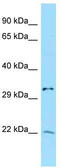 Transcription Factor 25 antibody, TA344566, Origene, Western Blot image 