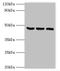 Synaptotagmin 11 antibody, orb353165, Biorbyt, Western Blot image 