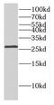 Distal-Less Homeobox 1 antibody, FNab02417, FineTest, Western Blot image 