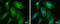 Myosin Heavy Chain 10 antibody, GTX634160, GeneTex, Immunofluorescence image 