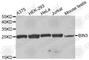 Bridging Integrator 3 antibody, A3464, ABclonal Technology, Western Blot image 