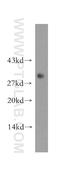 Carbonyl Reductase 3 antibody, 15619-1-AP, Proteintech Group, Western Blot image 