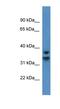 NFKB Inhibitor Delta antibody, NBP1-79856, Novus Biologicals, Western Blot image 